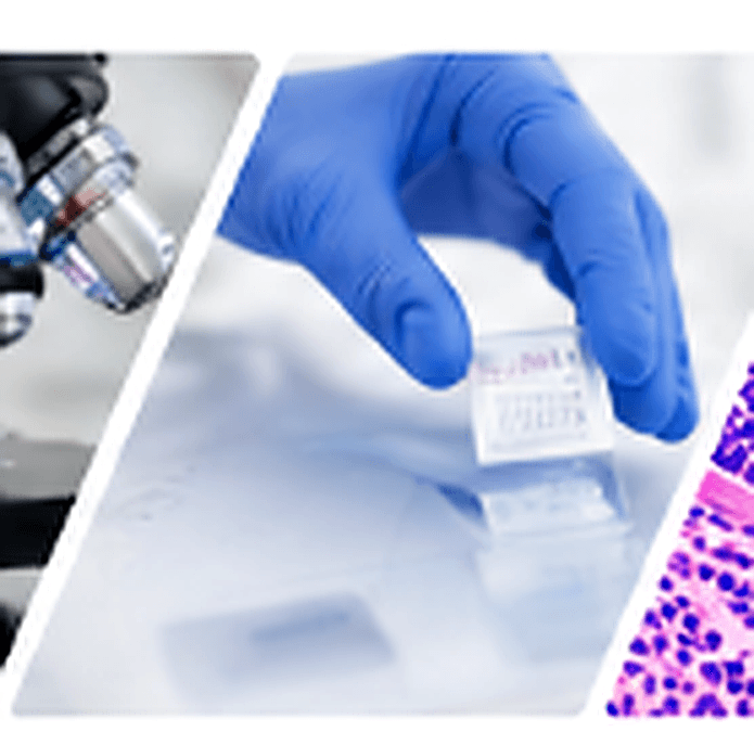 Gloved hand preparing a histology slide